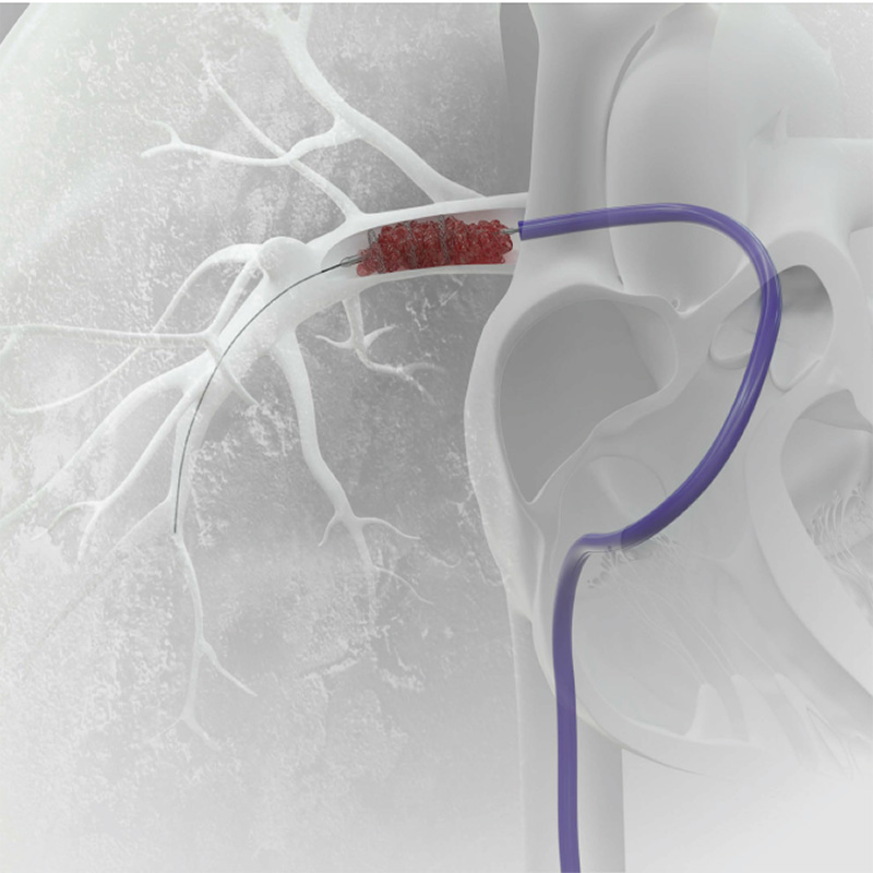 Developing Brand Guidelines for Inari Medical