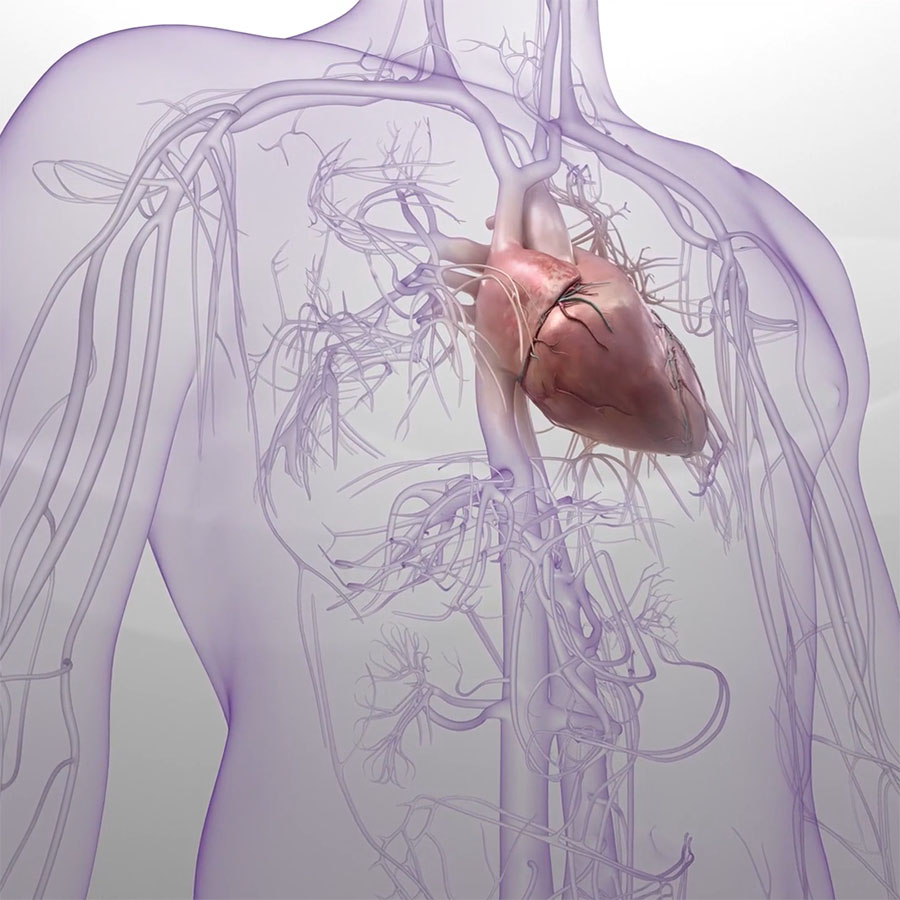 Crafted Precision with Inari Medical Animation